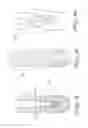 Fig. 11 - Dental implant for bone collection and distribution