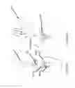 Fig. 20 - Dental implant for bone collection and distribution