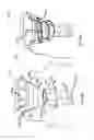 Fig. 21 - Dental implant for bone collection and distribution