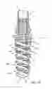 Fig. 02 - Dental implant