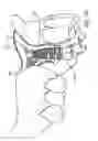 Fig. 08 - Dental implant