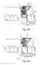 Fig. 09 - Dental implant