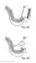 Fig. 10 - Dental implant