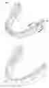 Fig. 01 - Dental implant positioning