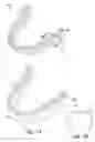Fig. 02 - Dental implant positioning