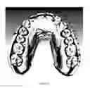 Fig. 03 - Method for creating flexible arch model of teeth for use in restorative dentistry