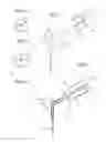 Fig. 02 - ROOT CANAL IRRIGATION NEEDLE ENHANCEMENT