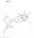 Fig. 04 - ROOT CANAL IRRIGATION NEEDLE ENHANCEMENT