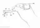 Fig. 01 - Root canal treating device