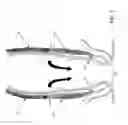 Fig. 02 - METHOD AND APPARATUS FOR ENDOSCOPICALLY TREATING RECTAL PROLAPSE