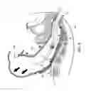 Fig. 10 - METHOD AND APPARATUS FOR ENDOSCOPICALLY TREATING RECTAL PROLAPSE