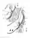 Fig. 12 - METHOD AND APPARATUS FOR ENDOSCOPICALLY TREATING RECTAL PROLAPSE