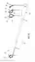 Fig. 16 - METHOD AND APPARATUS FOR ENDOSCOPICALLY TREATING RECTAL PROLAPSE