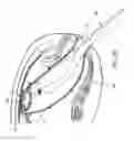 Fig. 20 - METHOD AND APPARATUS FOR ENDOSCOPICALLY TREATING RECTAL PROLAPSE