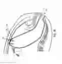 Fig. 26 - METHOD AND APPARATUS FOR ENDOSCOPICALLY TREATING RECTAL PROLAPSE