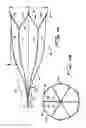 Fig. 04 - Vein filter