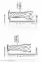 Fig. 07 - Devices and methods for effectuating percutaneous Glenn and Fontan procedures