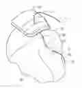 Fig. 01 - TRANSOSSEOUS SUTURE CONSTRUCTS