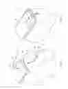 Fig. 02 - TRANSOSSEOUS SUTURE CONSTRUCTS