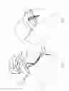 Fig. 08 - TRANSOSSEOUS SUTURE CONSTRUCTS