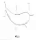 Fig. 06 - Breast treatment device