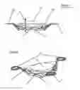 Fig. 05 - Double accommodating intraocular accordion lens