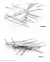 Fig. 07 - Double accommodating intraocular accordion lens