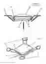 Fig. 10 - Double accommodating intraocular accordion lens