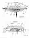 Fig. 13 - Double accommodating intraocular accordion lens