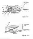 Fig. 15 - Double accommodating intraocular accordion lens