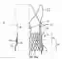 Fig. 01 - Transcatheter stent-valves and methods, systems and devices for addressing para-valve leakage