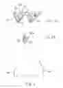 Fig. 03 - Transcatheter stent-valves and methods, systems and devices for addressing para-valve leakage