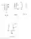 Fig. 05 - Transcatheter stent-valves and methods, systems and devices for addressing para-valve leakage