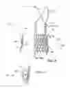 Fig. 13 - Transcatheter stent-valves and methods, systems and devices for addressing para-valve leakage
