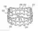 Fig. 01 - Methods of identifying and replacing implanted heart valves