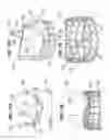 Fig. 10 - Methods of identifying and replacing implanted heart valves