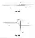 Fig. 08 - Systems and methods for deploying a cardiac anchor