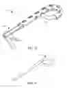 Fig. 06 - SUPER-ELASTIC IMPLANT SYSTEM