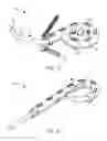 Fig. 07 - SUPER-ELASTIC IMPLANT SYSTEM