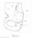 Fig. 02 - Implant anchoring device