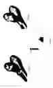 Fig. 06 - Method for producing a customised orthopaedic implant