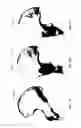 Fig. 14 - Method for producing a customised orthopaedic implant