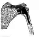 Fig. 01 - Arthroplasty components