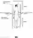 Fig. 02 - Arthroplasty components