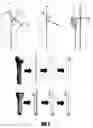 Fig. 04 - Arthroplasty components