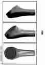 Fig. 06 - Arthroplasty components