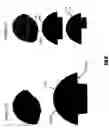 Fig. 09 - Arthroplasty components