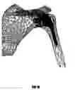Fig. 17 - Arthroplasty components