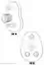 Fig. 19 - Arthroplasty components