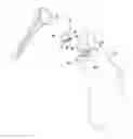 Fig. 01 - Glenoid defect-filling component